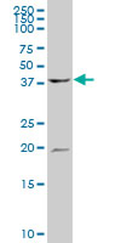 ATP6V1C1 polyclonal antibody (A01)