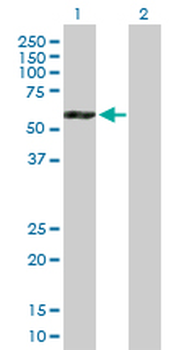ATP6V1B2 purified MaxPab mouse polyclonal antibody (B01P)
