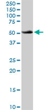 ATP6V1B1 purified MaxPab rabbit polyclonal antibody (D01P)