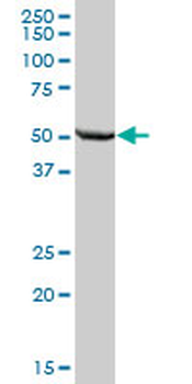 ALDH7A1 purified MaxPab mouse polyclonal antibody (B01P)