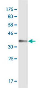 ATP2B4 monoclonal antibody (M03A), clone 2C7
