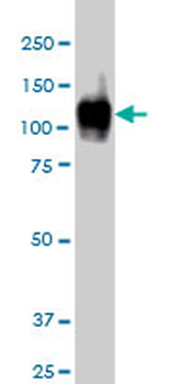 ATP2A1 monoclonal antibody (M01), clone 1B11