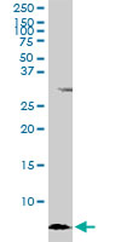 ATOX1 monoclonal antibody (M09), clone 3A1