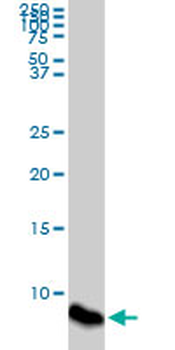 ATOX1 monoclonal antibody (M08), clone 4D6