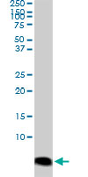 ATOX1 monoclonal antibody (M04), clone 3G11