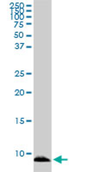 ATOX1 monoclonal antibody (M02), clone 3A2
