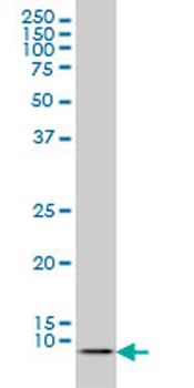 ATOX1 monoclonal antibody (M01), clone 2E6
