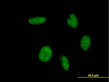 ATOH1 monoclonal antibody (M09), clone 4H2
