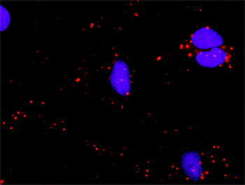 ATF4 purified MaxPab rabbit polyclonal antibody (D01P)