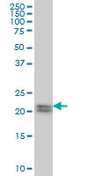 ATF3 monoclonal antibody (M04), clone 8G5