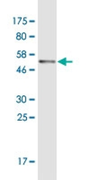 SERPINC1 monoclonal antibody (M01), clone 3G9