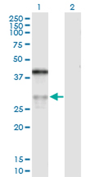 ASPH purified MaxPab rabbit polyclonal antibody (D01P)