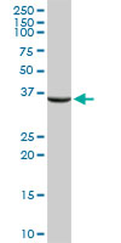 ASPA purified MaxPab rabbit polyclonal antibody (D01P)