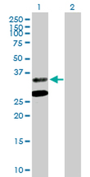 ASPA purified MaxPab mouse polyclonal antibody (B01P)
