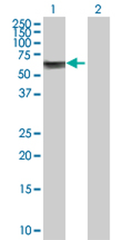 ASNS purified MaxPab rabbit polyclonal antibody (D01P)
