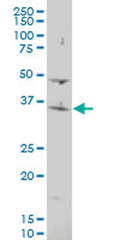ASMT polyclonal antibody (A01)
