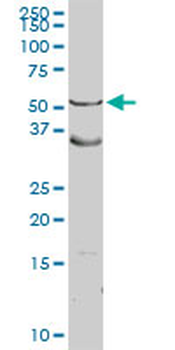 ASL purified MaxPab rabbit polyclonal antibody (D01P)