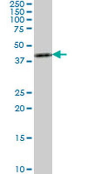 ASCL1 monoclonal antibody (M03), clone 3D3