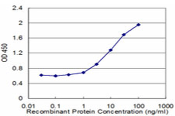 ASAH1 monoclonal antibody (M02), clone 1A7