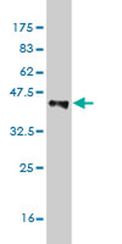 ASAH1 monoclonal antibody (M01), clone 2C9