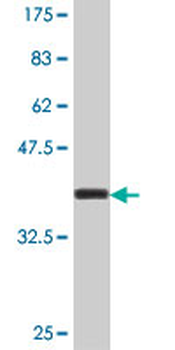 ARSE polyclonal antibody (A01)
