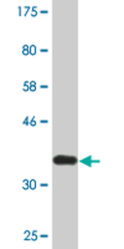 ARNT monoclonal antibody (M02A), clone 1F12