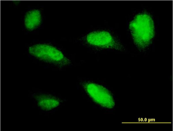 PHOX2A monoclonal antibody (M01), clone 4F6