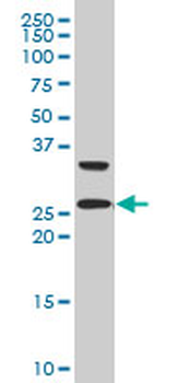 ARHGDIG polyclonal antibody (A01)