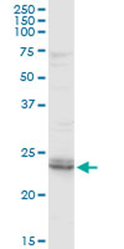ARHGDIB purified MaxPab rabbit polyclonal antibody (D01P)