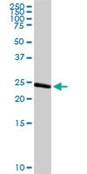 ARHGDIA purified MaxPab rabbit polyclonal antibody (D01P)