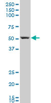 ARHGAP1 polyclonal antibody (A01)