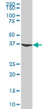 ARG1 purified MaxPab mouse polyclonal antibody (B01P)
