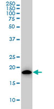 ARF5 monoclonal antibody (M01), clone 1B4