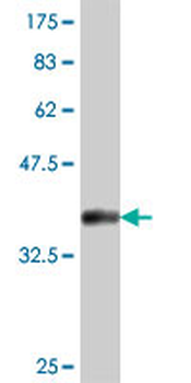 ARF5 polyclonal antibody (A01)