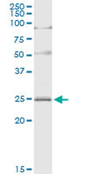 ARL4D MaxPab rabbit polyclonal antibody (D01)