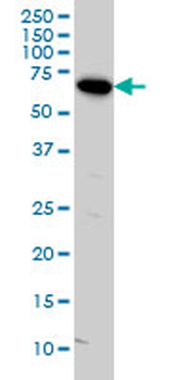 ARAF monoclonal antibody (M05), clone 3E2