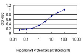 ABCC6 monoclonal antibody (M01), clone 1E6