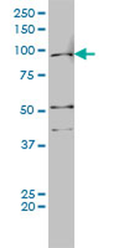 AR monoclonal antibody (M01), clone 1G3
