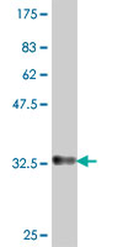 APOC2 polyclonal antibody (A01)