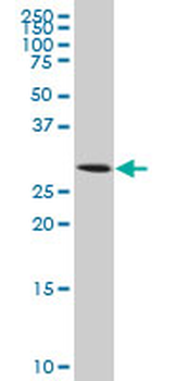 AQP8 monoclonal antibody (M03), clone 1F8