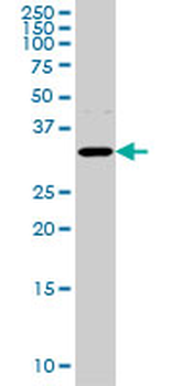 AQP8 monoclonal antibody (M01), clone 1A1