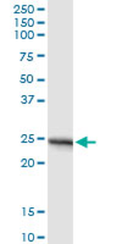 APOA1 monoclonal antibody (M01), clone S1