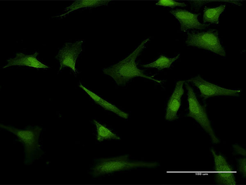 BIRC5 MaxPab rabbit polyclonal antibody (D01)