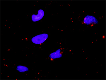 BIRC2 purified MaxPab rabbit polyclonal antibody (D01P)