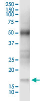NUDT2 MaxPab rabbit polyclonal antibody (D01)