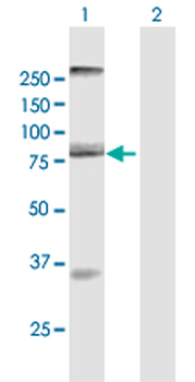 AOC2 purified MaxPab mouse polyclonal antibody (B01P)