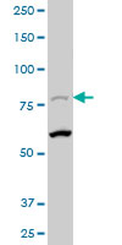 AOC2 polyclonal antibody (A01)
