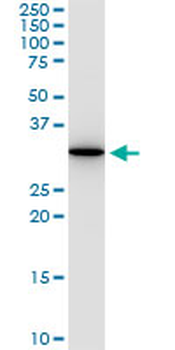 ANXA5 monoclonal antibody (M01), clone 1F4-1A5