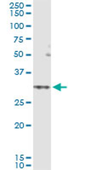 SLC25A5 MaxPab rabbit polyclonal antibody (D03)