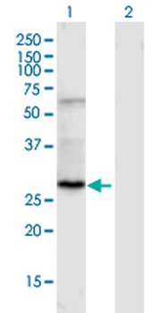 SLC25A5 MaxPab mouse polyclonal antibody (B02)